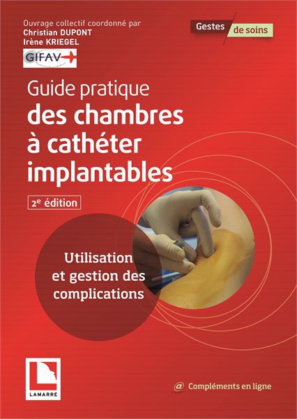 Guide pratique des chambres à cathéter implantables - 2e édition